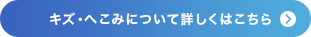 キズ・へこみについて詳しくはこちら